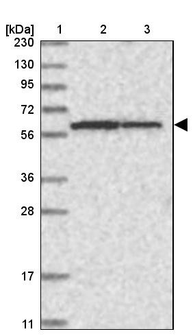 Lane 1: Marker [kDa] 230, 130, 95, 72, 56, 36, 28, 17, 11<br/>Lane 2: Human cell line RT-4<br/>Lane 3: Human cell line U-251MG sp