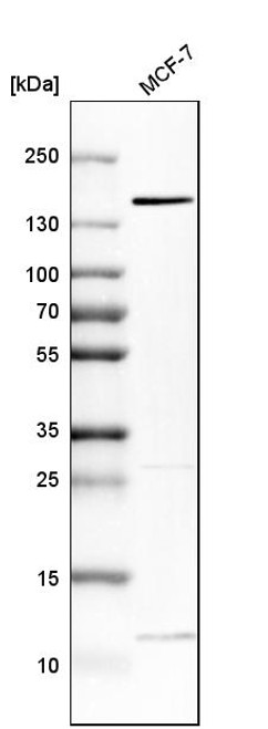 Western blot analysis in human cell line MCF-7. Western blot analysis in human cell line MCF-7.