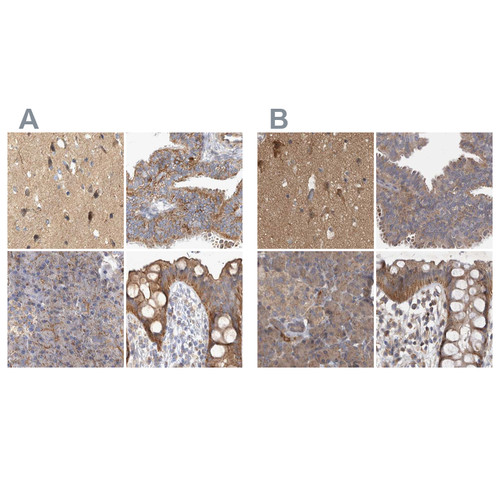 Immunohistochemical staining of human cerebral cortex, fallopian tube, pancreas and rectum using Anti-TSPOAP1 antibody HPA024662 (A) shows similar protein distribution across tissues to independent antibody HPA025244 (B).
