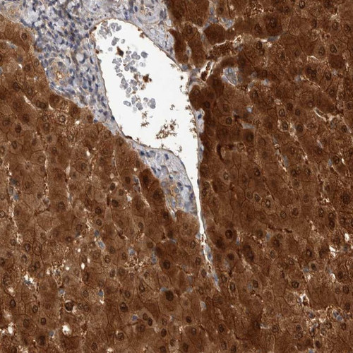 Immunohistochemical staining of human liver shows strong cytoplasmic and nuclear positivity in hepatocytes.