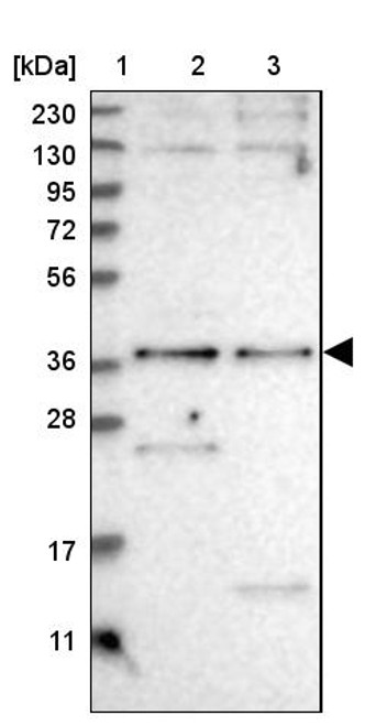 Lane 1: Marker [kDa] 230, 130, 95, 72, 56, 36, 28, 17, 11<br/>Lane 2: Human cell line RT-4<br/>Lane 3: Human cell line U-251MG sp