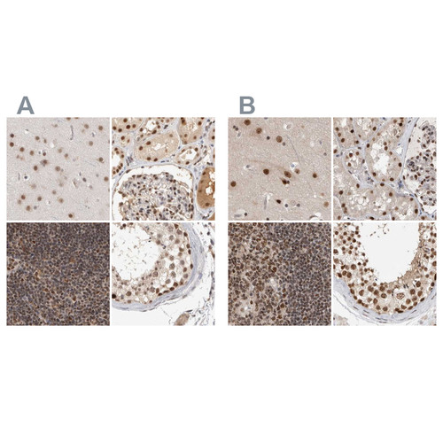 Immunohistochemical staining of human cerebral cortex, kidney, lymph node and testis using Anti-ZNF830 antibody HPA024754 (A) shows similar protein distribution across tissues to independent antibody HPA027211 (B).