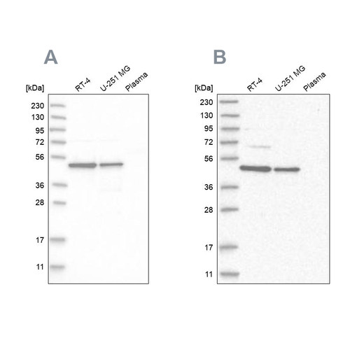 Western blot analysis using Anti-ZNF830 antibody HPA024754 (A) shows similar pattern to independent antibody HPA027211 (B).