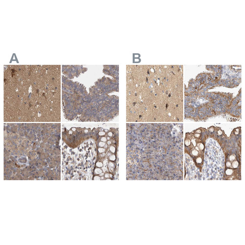 Immunohistochemical staining of human cerebral cortex, fallopian tube, pancreas and rectum using Anti-TSPOAP1 antibody HPA025244 (A) shows similar protein distribution across tissues to independent antibody HPA024662 (B).