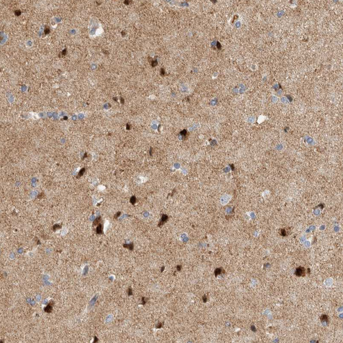 Immunohistochemical staining of human cerebral cortex shows moderate to strong cytoplasmic positivity in neurons.
