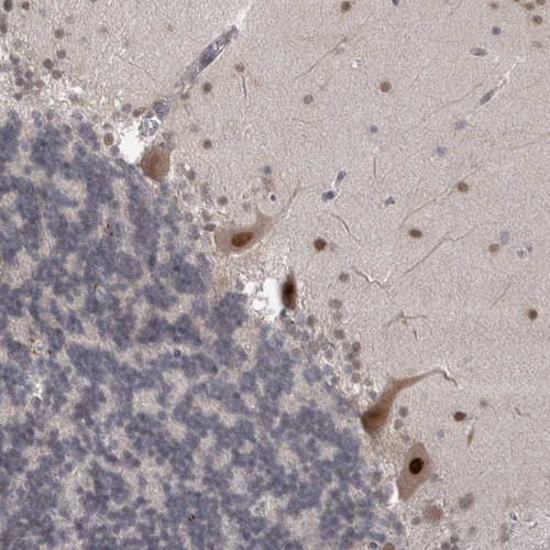 Immunohistochemical staining of human cerebellum shows strong nuclear positivity in Purkinje cells.