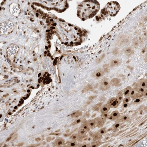 Immunohistochemical staining of human placenta shows strong nuclear positivity in trophoblastic cells and decidual cells.