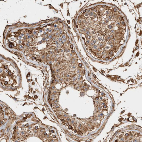 Immunohistochemical staining of human testis shows strong granular cytoplasmic positivity in cells in seminiferous ducts.