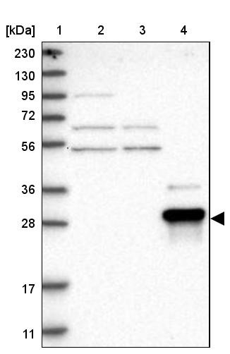 Lane 1: Marker [kDa] 230, 130, 95, 72, 56, 36, 28, 17, 11<br/>Lane 2: Human cell line RT-4<br/>Lane 3: Human cell line U-251MG sp<br/>Lane 4: Human plasma (IgG/HSA depleted)