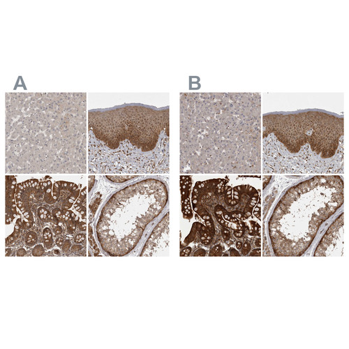 Immunohistochemical staining of human liver, skin, small intestine and testis using Anti-STK24 antibody HPA026435 (A) shows similar protein distribution across tissues to independent antibody HPA026502 (B).