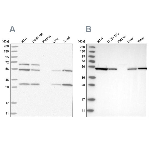 Western blot analysis using Anti-STK24 antibody HPA026435 (A) shows similar pattern to independent antibody HPA026502 (B).