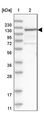 Lane 1: Marker [kDa] 230, 130, 95, 72, 56, 36, 28, 17, 11<br/>Lane 2: Human cell line RT-4