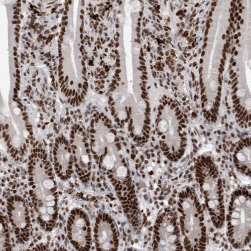 Immunohistochemical staining of human duodenum shows strong nuclear positivity in glandular cells.