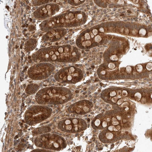 Immunohistochemical staining of human duodenum shows strong cytoplasmic positivity in glandular cells.