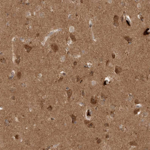 Immunohistochemical staining of human cerebral cortex shows strong cytoplasmic positivity in neurons.