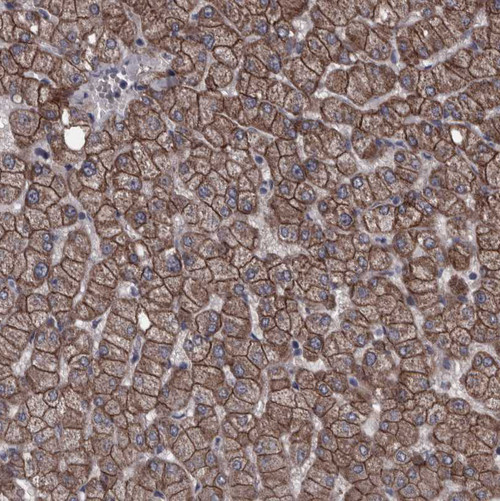 Immunohistochemical staining of human liver shows strong membranous positivity in hepatocytes.