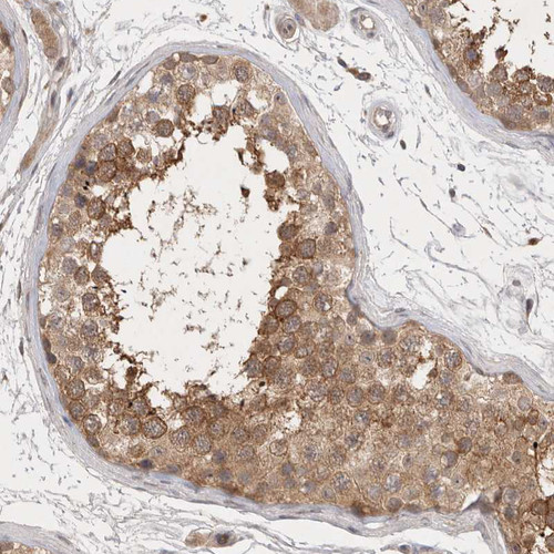 Immunohistochemical staining of human testis shows moderate cytoplasmic positivity in cells in seminiferous ducts.