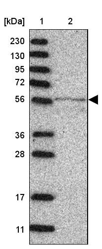 Lane 1: Marker [kDa] 230, 130, 95, 72, 56, 36, 28, 17, 11<br/>Lane 2: Human cell line RT-4