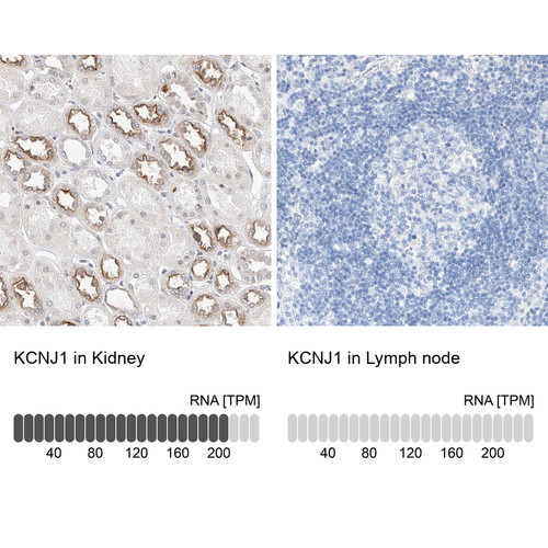 Immunohistochemistry analysis in human kidney and lymph node tissues using Anti-KCNJ1 antibody. Corresponding KCNJ1 RNA-seq data are presented for the same tissues.
