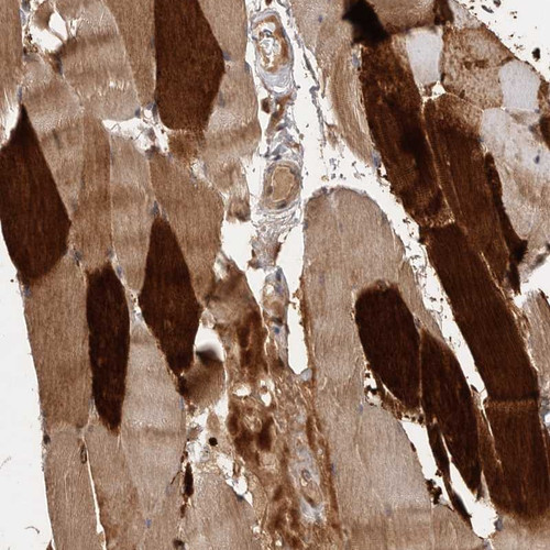 Immunohistochemical staining of human skeletal muscle shows strong cytoplasmic positivity in myocytes.
