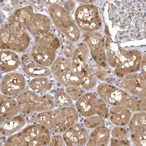 Immunohistochemical staining of human kidney shows moderate cytoplasmic positivity in cells in tubules.