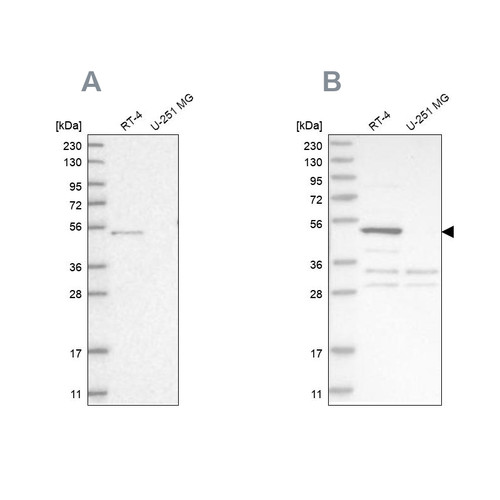 Western blot analysis using Anti-SCP2 antibody HPA027317 (A) shows similar pattern to independent antibody HPA027135 (B).