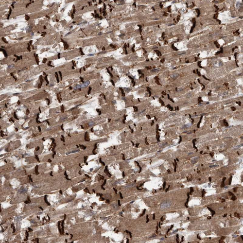 Immunohistochemical staining of human heart muscle shows strong positivity in intercalated discs.