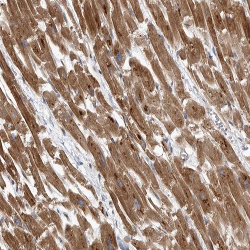 Immunohistochemical staining of human heart muscle shows strong cytoplasmic positivity in myocytes.