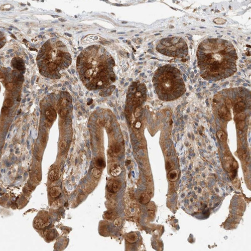 Immunohistochemical staining of human colon shows strong cytoplasmic positivity in glandular cells.