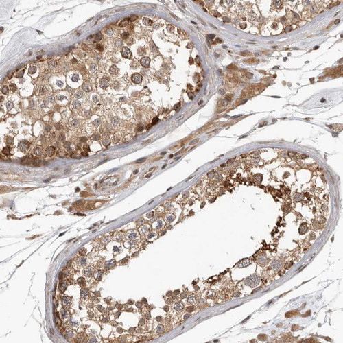 Immunohistochemical staining of human testis shows moderate cytoplasmic positivity in cells in seminiferous ducts.