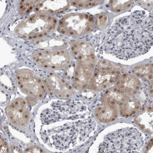 Immunohistochemical staining of human kidney shows moderate nuclear and cytoplasmic positivity in cells in tubules.