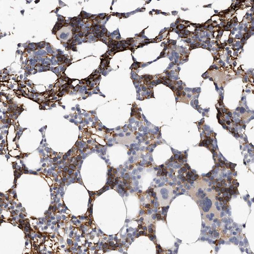 Immunohistochemical staining of human bone marrow shows moderate membranous positivity in hematopoietic cells.
