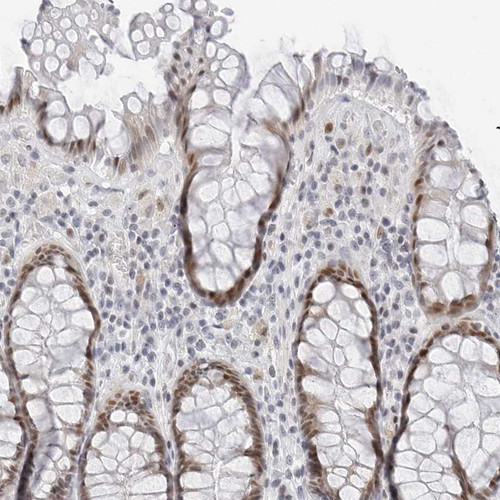 Immunohistochemical staining of human rectum shows moderate nuclear positivity in glandular cells.