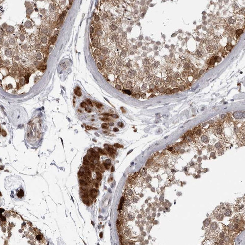 Immunohistochemical staining of human testis shows strong cytoplasmic positivity in leydig cells.