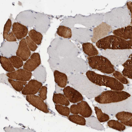 Immunohistochemical staining of human Skeletal muscle shows strong cytoplasmic positivity in myocytes. Immunohistochemical staining of human Skeletal muscle shows strong cytoplasmic positivity in myocytes.