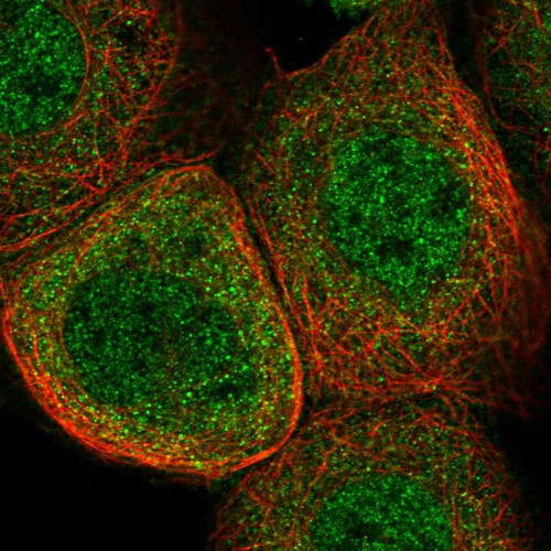 Immunofluorescent staining of human cell line A-431 shows localization to nucleoplasm & cytosol.