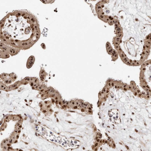 Immunohistochemical staining of human placenta shows strong nuclear positivity in trophoblastic cells.
