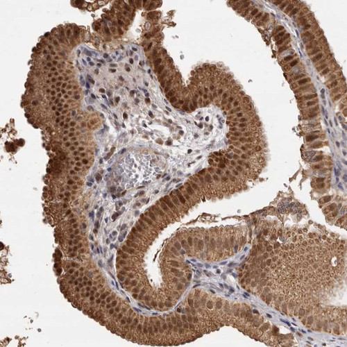 Immunohistochemical staining of human gall bladder shows strong nuclear and cytoplasmic positivity in glandular cells.