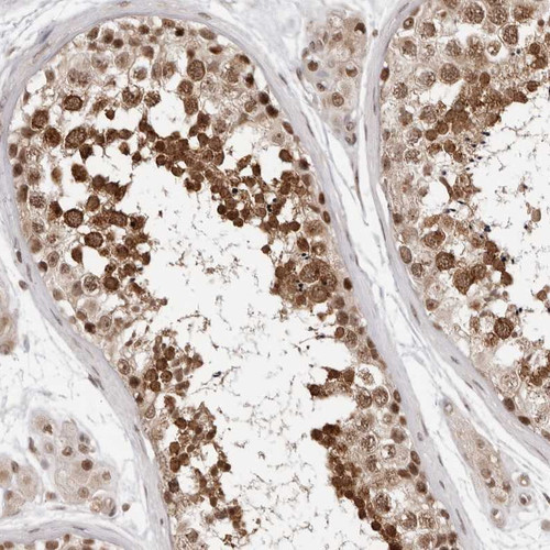 Immunohistochemical staining of human testis shows strong nuclear and cytoplasmic positivity in cells in seminiferus ducts.