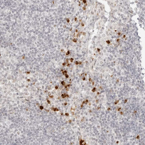 Immunohistochemical staining of human lymph node shows strong cytoplasmic positivity in subset of non-germinal center cells.
