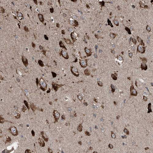 Immunohistochemical staining of human cerebral cortex shows strong cytoplasmic positivity in neurons.