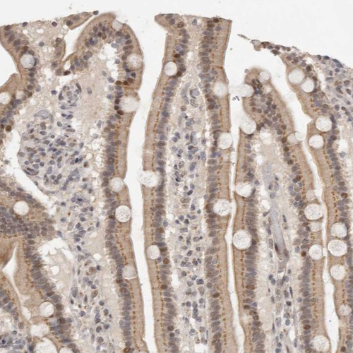 Immunohistochemical staining of human duodenum shows moderate cytoplasmic and nuclear positivity in glandular cells.