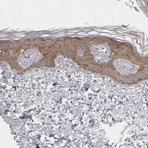 Immunohistochemical staining of human skin shows strong cytoplasmic positivity in squamous epithelial cells.
