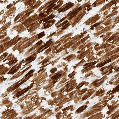 Immunohistochemical staining of human heart muscle shows strong positivity in myocytes.