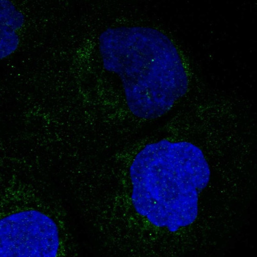 Immunofluorescent staining of human cell line A-431 shows localization to mitochondria.