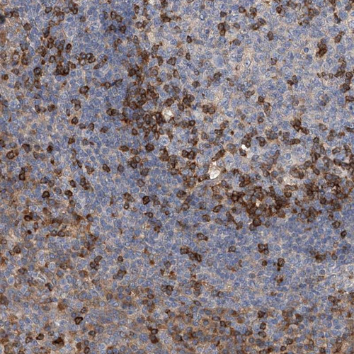 Immunohistochemical staining of human tonsil shows strong cytoplasmic positivity in subsets of lymphoid cells.