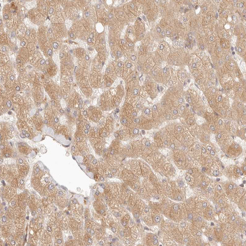 Immunohistochemical staining of human liver shows moderate cytoplasmic positivity in hepatocytes.