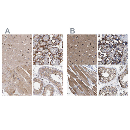 Immunohistochemical staining of human cerebral cortex, colon, kidney and testis using Anti-MECR antibody HPA028740 (A) shows similar protein distribution across tissues to independent antibody HPA022018 (B).