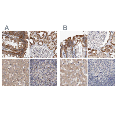 Immunohistochemical staining of human colon, kidney, liver and lymph node using Anti-MRPL18 antibody HPA028774 (A) shows similar protein distribution across tissues to independent antibody HPA028775 (B).