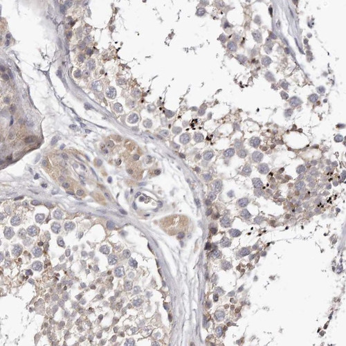 Immunohistochemical staining of human testis shows cytoplasmic positivity in cells in seminiferous ducts.